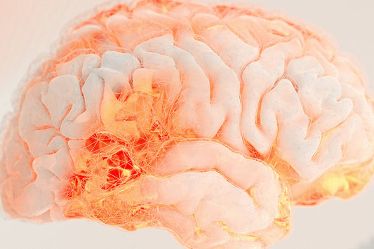 Mushroom Complex 10 X for Focus, Brain Fog, and Daily Mental Endurance